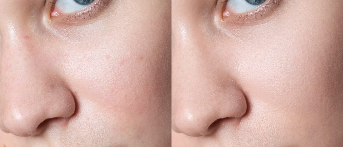 Retouch4me AI
